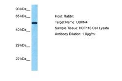 UBXD2 Antibody, Novus Biologicals 100 &mu;L | Buy Online | Novus Biologicals | Fisher Scientific